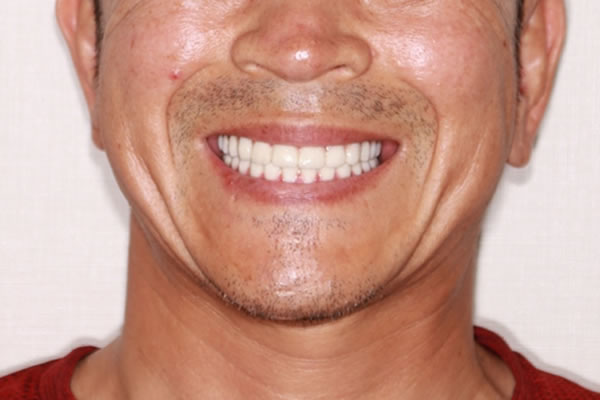 After